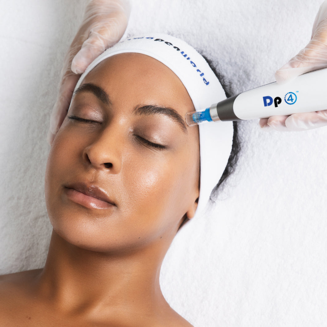 Microneedling - Add on